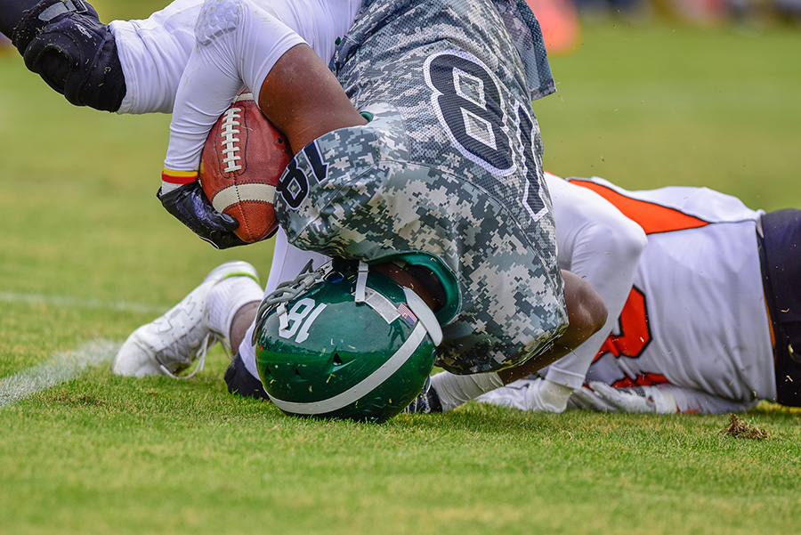 CT Scan vs. MRI - What's Best for a Sports-related Concussion? - Simply ...